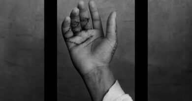 Hunter - Take Me To The Hospital 1