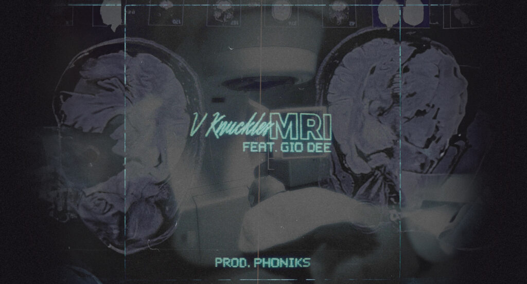 V Knuckles & Phoniks - MRI