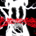 Funeral - suffer
