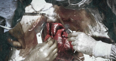 TG Kommas - Heart Surgery