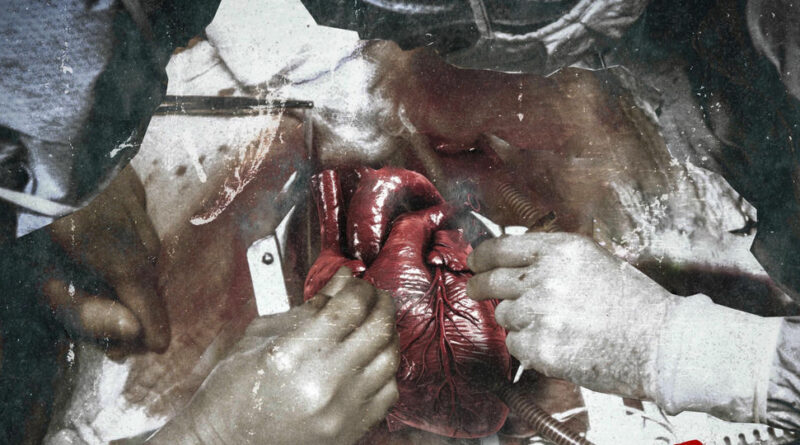 TG Kommas - Heart Surgery