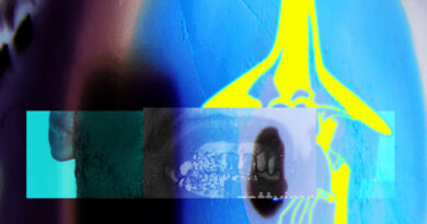 E L U C I D & Sebb Bash - I Guess U Had To Be There